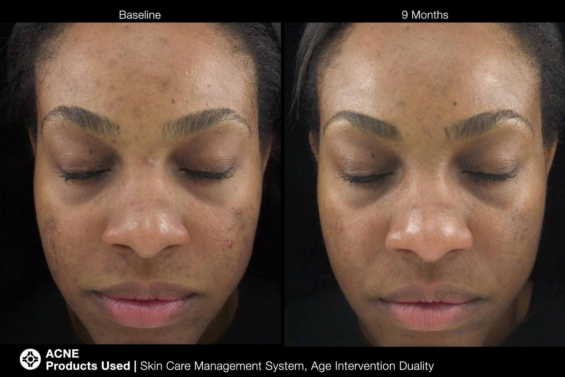 Age Intervention® Duality™ - Image 5