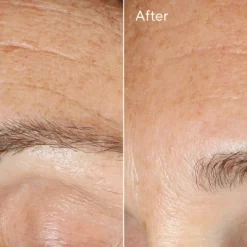 Alternative view of Replenishing Multi-Acid Peel