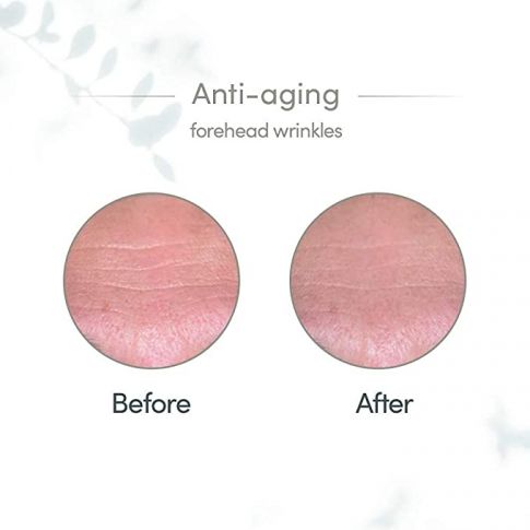 Glyconight 10% Mask - Image 5