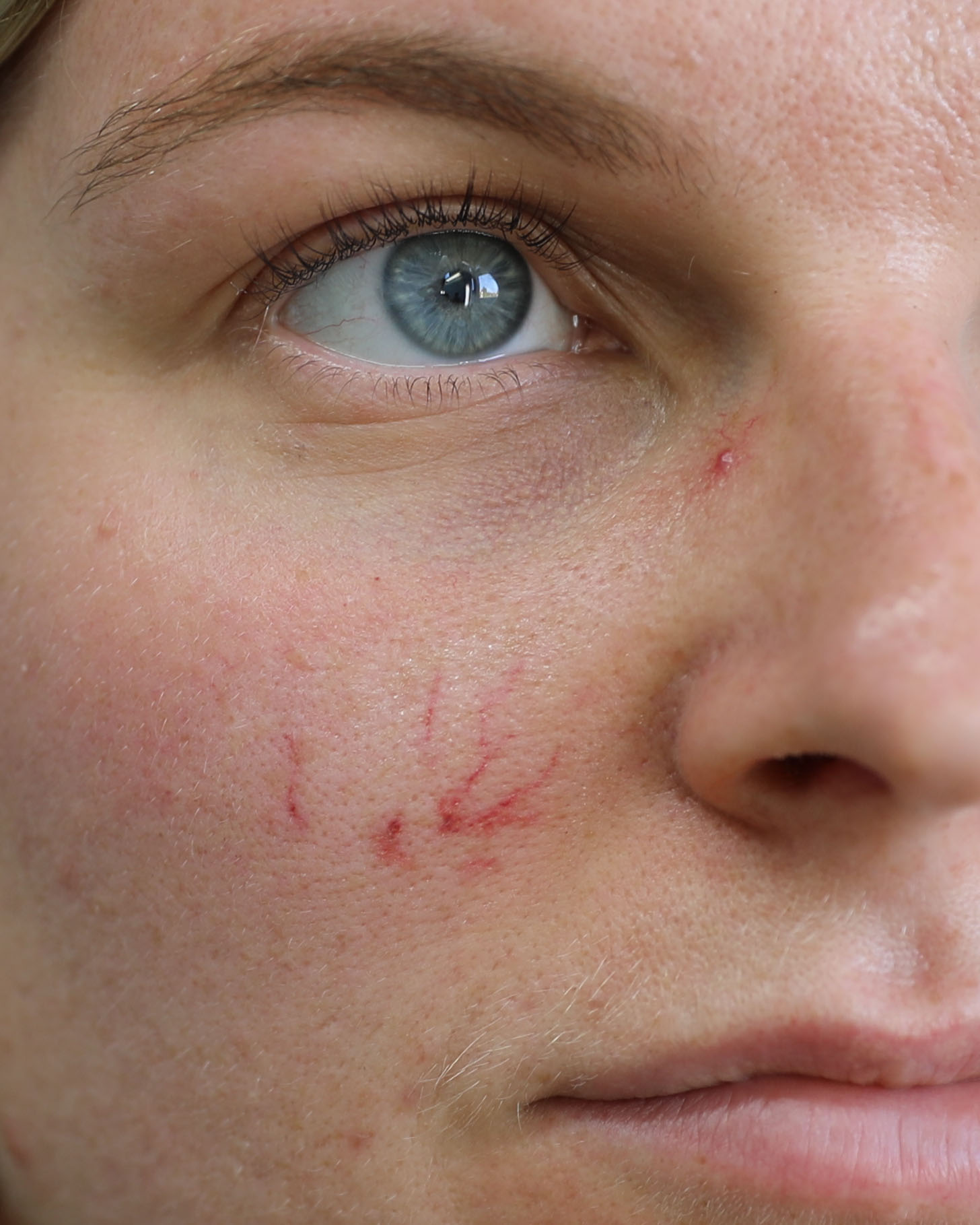 Vessels Veins - Image 3