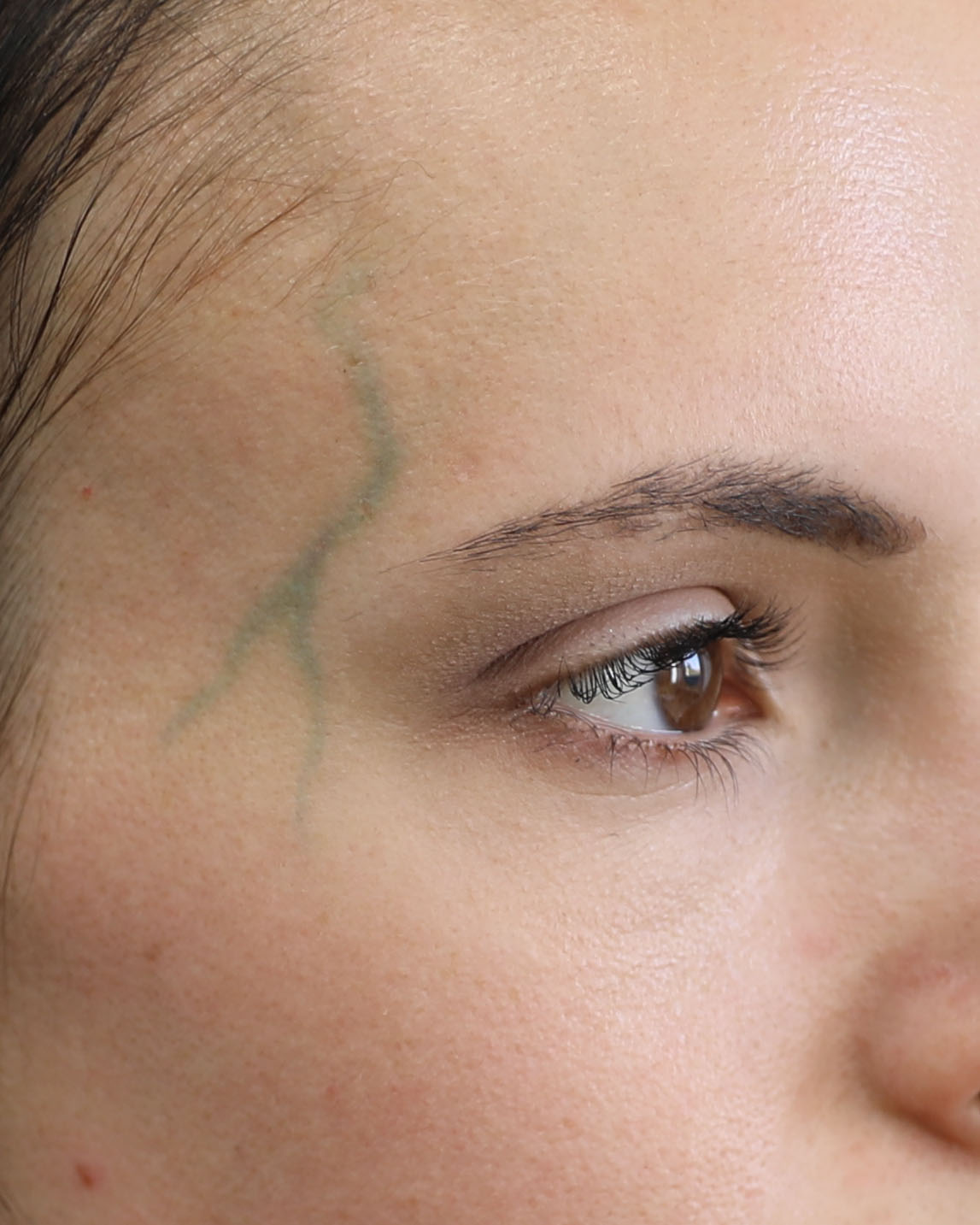 Vessels Veins - Image 4