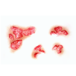 Alternative view of 3D FX Transfers - Burned Flesh