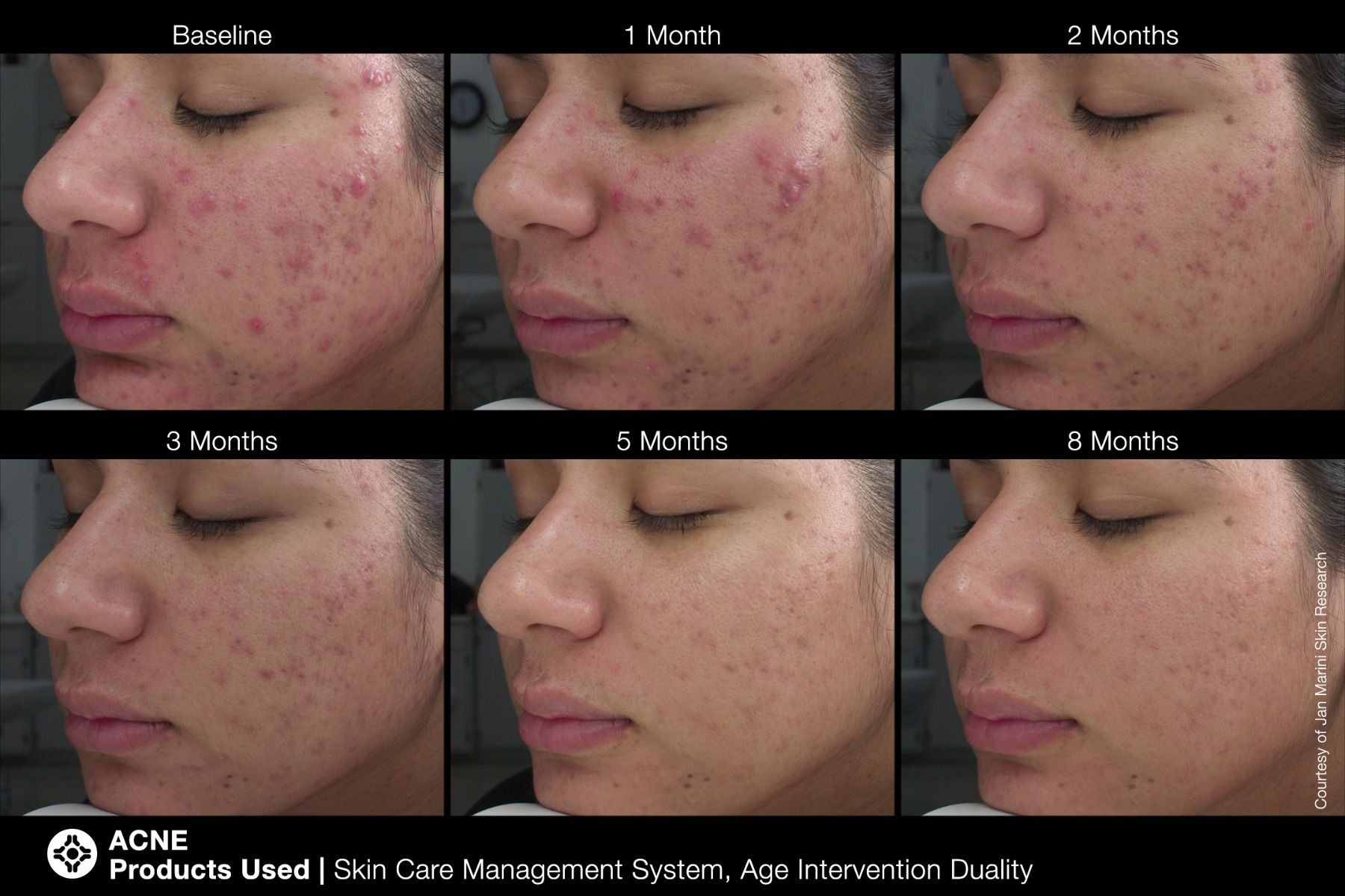 Age Intervention® Duality™ - Image 6