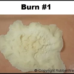 Burn #1 - FRW-060