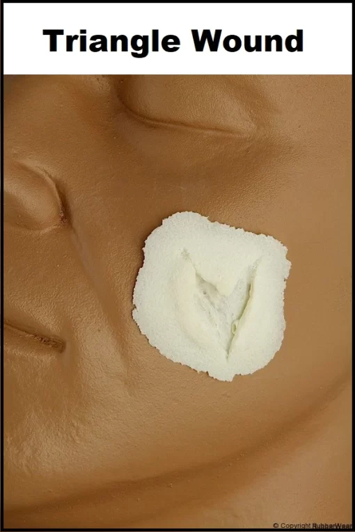 Triangle Wound
