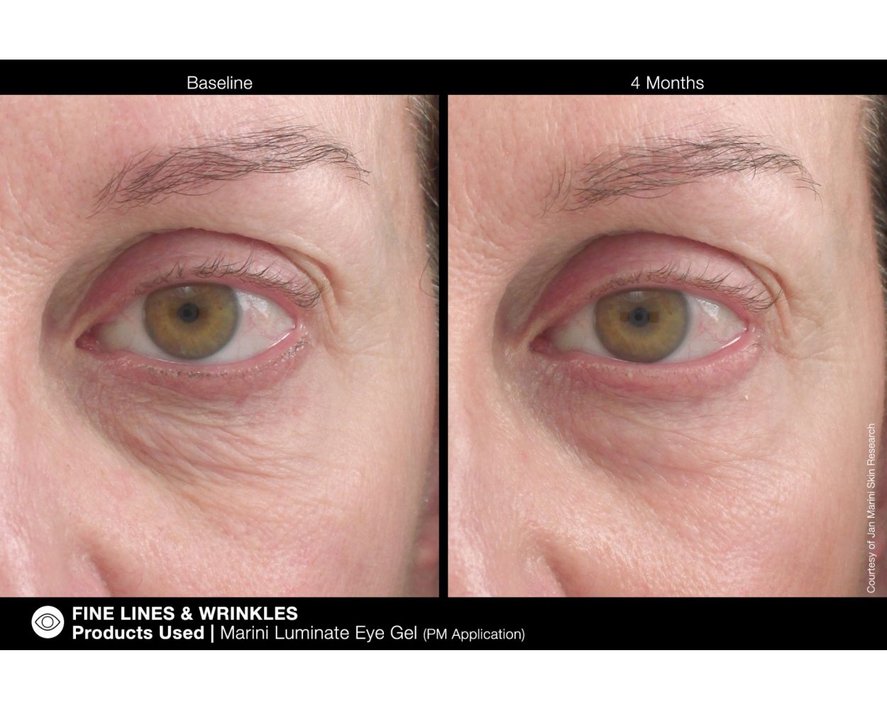 Marini Luminate® Eye Gel - Image 5