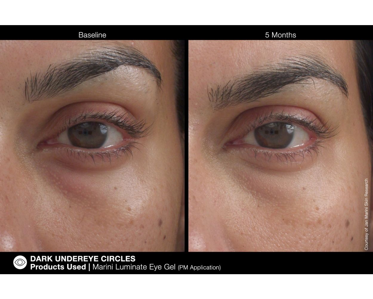 Marini Luminate® Eye Gel - Image 4