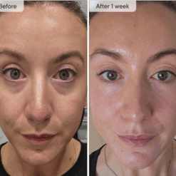 Alternative view of Micro-Infusion Targeted Patches 8 Pair