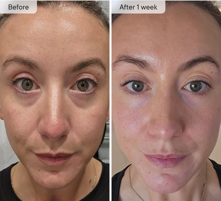 Micro-Infusion Targeted Patches 8 Pair - Image 2