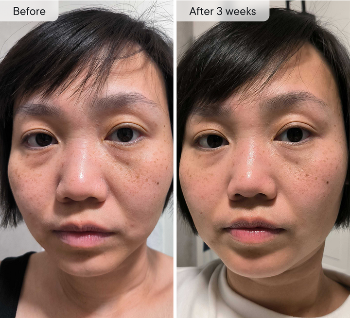 Micro-Infusion Targeted Patches 8 Pair - Image 3