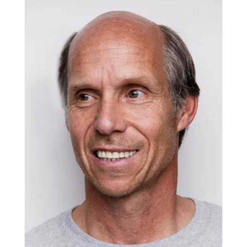 Men's Wigs - Sides & Back