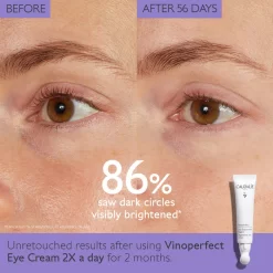 Alternative view of Vinoperfect Dark Circle Brightening Eye Cream