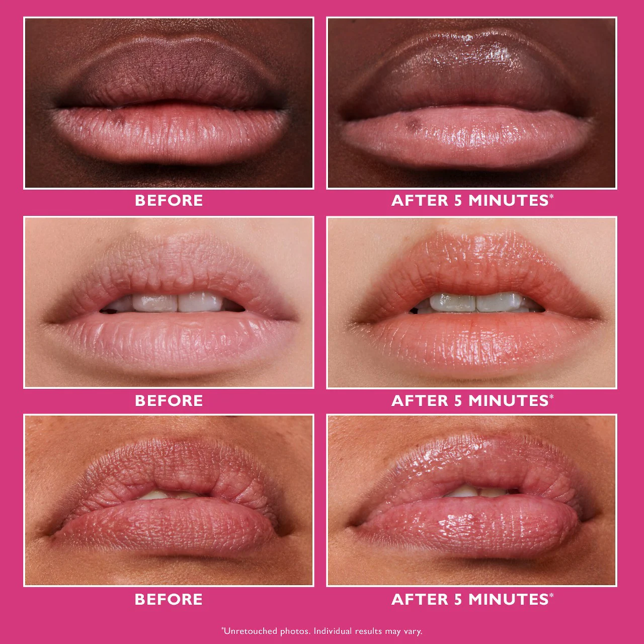 Instant FIRMx® Lip Filler - Image 3